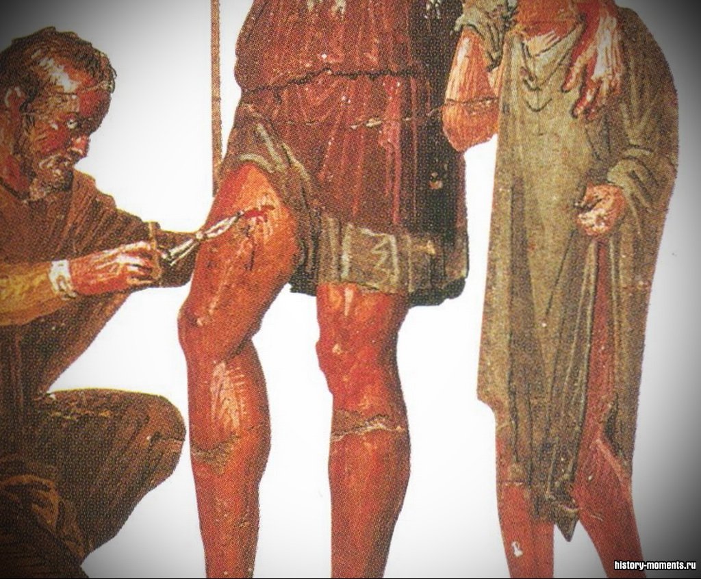 На этой фреске врач лечит героя Энея.